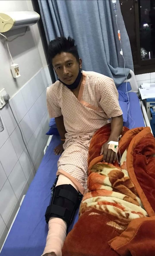 नवयुगकाे घुँडाकाे सफल शल्यक्रिया, कम्तिमा ८ साता मैदान बाहिर